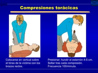 Compresiones torácicas Presionar; hundir el esternón 4-5 cm. Soltar tras cada compresión.  Frecuencia 100/minuto. Colocarse en vertical sobre el tórax de la víctima con los brazos rectos. 