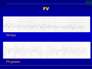 FV FV fina FV gruesa 