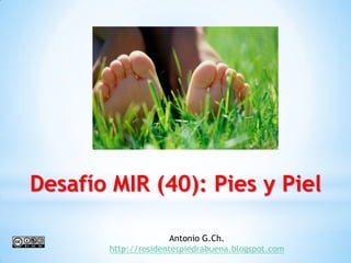 Desafío MIR (40): Pies y Piel

                      Antonio G.Ch.
       http://residentespiedrabuena.blogspot.com
 