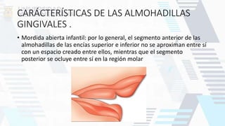 CARÁCTERÍSTICAS DE LAS ALMOHADILLAS
GINGIVALES .
• Mordida abierta infantil: por lo general, el segmento anterior de las
almohadillas de las encías superior e inferior no se aproximan entre sí
con un espacio creado entre ellos, mientras que el segmento
posterior se ocluye entre sí en la región molar
 