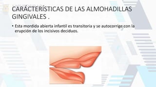 CARÁCTERÍSTICAS DE LAS ALMOHADILLAS
GINGIVALES .
• Esta mordida abierta infantil es transitoria y se autocorrige con la
erupción de los incisivos deciduos.
 