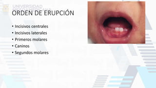 ORDEN DE ERUPCIÓN
• Incisivos centrales
• Incisivos laterales
• Primeros molares
• Caninos
• Segundos molares
 