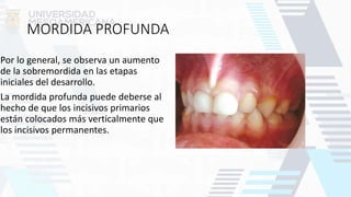 MORDIDA PROFUNDA
Por lo general, se observa un aumento
de la sobremordida en las etapas
iniciales del desarrollo.
La mordida profunda puede deberse al
hecho de que los incisivos primarios
están colocados más verticalmente que
los incisivos permanentes.
 
