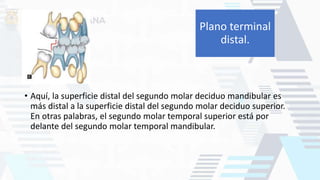 • Aquí, la superficie distal del segundo molar deciduo mandibular es
más distal a la superficie distal del segundo molar deciduo superior.
En otras palabras, el segundo molar temporal superior está por
delante del segundo molar temporal mandibular.
Plano terminal
distal.
 