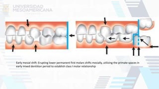 Early mesial shift: Erupting lower permanent first molars shifts mesially, utilizing the primate spaces in
early mixed dentition period to establish class I molar relationship
 