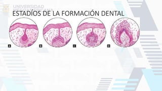 ESTADÍOS DE LA FORMACIÓN DENTAL
 