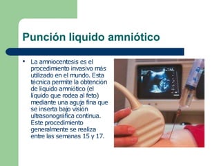 Punción liquido amniótico
● La amniocentesis es el
procedimiento invasivo más
utilizado en el mundo. Esta
técnica permite la obtención
de líquido amniótico (el
líquido que rodea al feto)
mediante una aguja fina que
se inserta bajo visión
ultrasonográfica continua.
Este procedimiento
generalmente se realiza
entre las semanas 15 y 17.
 