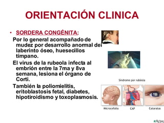 ORIENTACIÓN CLINICA SORDERA CONGÉNITA: Por lo general acompañado de mudez por desarrollo anormal del laberinto óseo, huesecillos tímpano. El virus de la rubeola infecta al embrión entre la 7ma y 8va semana, lesiona el órgano de Corti. También la poliomielitis, eritoblastosis fetal, diabetes, hipotiroidismo y toxoplasmosis. 