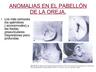 ANOMALIAS EN EL PABELLÓN DE LA OREJA. Los más comunes los apéndices ( acrocornodes) y las fositas preauriculares Depresiones poco profundas.  