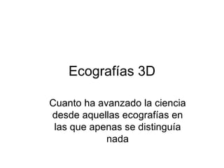 Ecografías 3D ,[object Object]