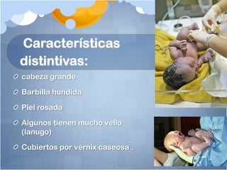 Características
distintivas:
cabeza grande

Barbilla hundida

Piel rosada

Algunos tienen mucho vello
(lanugo)

Cubiertos por vérnix caseosa .
 