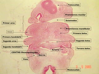 CENTRO Mesenquimatoso Vena Arteria Estomodeo Prominencia maxilar Prominencia mandibular Primer arco Segundo arco Primera hendidura Segunda hendidura Arteria Segunda bolsa Telencefalo Mielencefalo Nervio Tercera bolsa Primera bolsa 