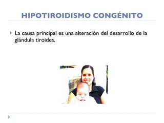 HIPOTIROIDISMO CONGÉNITO La causa principal es una alteración del desarrollo de la glándula tiroides. 