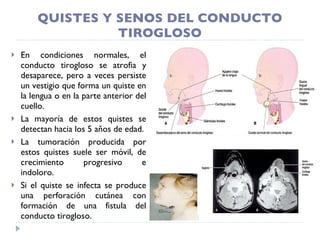 QUISTES Y SENOS DEL CONDUCTO TIROGLOSO En condiciones normales, el conducto tirogloso se atrofia y desaparece, pero a veces persiste un vestigio que forma un quiste en la lengua o en la parte anterior del cuello. La mayoría de estos quistes se detectan hacia los 5 años de edad. La tumoración producida por estos quistes suele ser móvil, de crecimiento progresivo e indoloro. Si el quiste se infecta se produce una perforación cutánea con formación de una fistula del conducto tirogloso. 