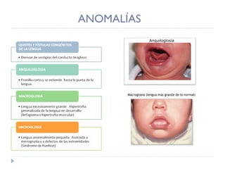 ANOMALÍAS Anquiloglosia 