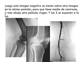 Luego esta imagen negativa se monta sobre otra imagen
en la misma posición, pero que tiene medio de contraste,
y más abajo otra película virgen. Y las 3 se exponen a la
luz
 