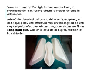 Tanto en la sustracción digital, como convencional, el
movimiento de la estructura afecta la imagen durante la
adquisición.
Además la densidad del campo debe ser homogéneo, es
decir, que si hay una estructura muy gruesa seguida de una
muy delgada, afecta en el contraste, para eso se usa filtros
compensadores. Que en el caso de la digital, también los
hay virtuales
 
