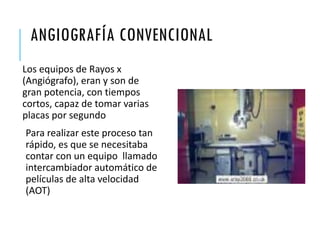 ANGIOGRAFÍA CONVENCIONAL
Los equipos de Rayos x
(Angiógrafo), eran y son de
gran potencia, con tiempos
cortos, capaz de tomar varias
placas por segundo
Para realizar este proceso tan
rápido, es que se necesitaba
contar con un equipo llamado
intercambiador automático de
películas de alta velocidad
(AOT)
 