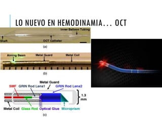 LO NUEVO EN HEMODINAMIA… OCT
 