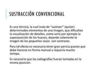 SUSTRACCIÓN CONVENCIONAL
Es una técnica, la cual trata de “sustraer” (quitar)
determinados elementos de una imagen, que dificultan
la visualización de detalles, como sería por ejemplo la
superposición de los huesos, dejando solamente la
imagen de los pequeños vasos con contraste.
Para tal efecto es necesaria tener gran pericia puesto que
debe hacerse en forma manual y requería mucho
tiempo.
Es necesario que las radiografías fueran tomadas en la
misma posición.
 