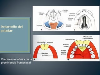 Crecimiento inferior de la
prominencia frontonasal