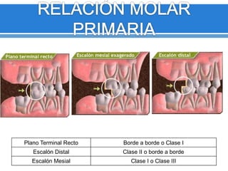 Plano Terminal Recto Borde a borde o Clase I 
Escalón Distal Clase II o borde a borde 
Escalón Mesial Clase I o Clase III 
 