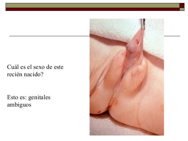 Featured image of post Aparato Reproductor Hermafrodita Im genes