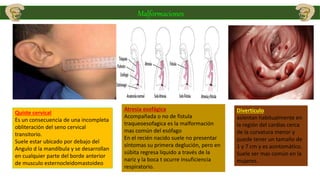 Malformaciones
Quiste cervical
Es un consecuencia de una incompleta
obliteración del seno cervical
transitorio.
Suele estar ubicado por debajo del
Angulo d la mandíbula y se desarrollan
en cualquier parte del borde anterior
de musculo esternocleidomastoideo
Atresia esofágica
Acompañada o no de fistula
traqueoesofagica es la malformación
mas común del esófago
En el recién nacido suele no presentar
síntomas su primera deglución, pero en
súbita regresa liquido a través de la
nariz y la boca t ocurre insuficiencia
respiratorio.
Divertículo
asientan habitualmente en
la región del cardias cerca
de la curvatura menor y
puede tener un tamaño de
1 y 7 cm y es asintomático.
Suele ser mas común en la
mujeres.
 