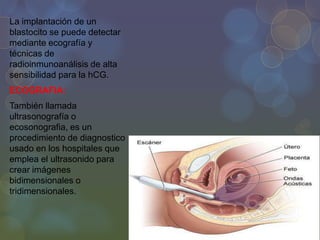 La implantación de un
blastocito se puede detectar
mediante ecografía y
técnicas de
radioinmunoanálisis de alta
sensibilidad para la hCG.
ECOGRAFIA:

También llamada
ultrasonografía o
ecosonografia, es un
procedimiento de diagnostico
usado en los hospitales que
emplea el ultrasonido para
crear imágenes
bidimensionales o
tridimensionales.

 