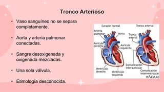 Tronco Arterioso
• Vaso sanguíneo no se separa
completamente.
• Aorta y arteria pulmonar
conectadas.
• Sangre desoxigenada y
oxigenada mezcladas.
• Una sola válvula.
• Etimología desconocida.
 