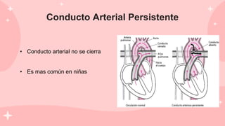 Conducto Arterial Persistente
• Conducto arterial no se cierra
• Es mas común en niñas
 