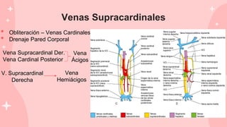 Venas Supracardinales
Vena Supracardinal Der.
Vena Cardinal Posterior
Vena
Ácigos
V. Supracardinal
Derecha
Vena
Hemiácigos
• Obliteración – Venas Cardinales
• Drenaje Pared Corporal
 