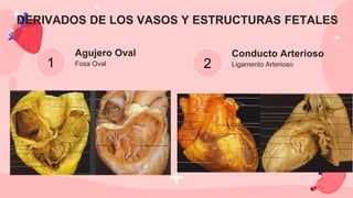 Conducto Arterioso
Fosa Oval Ligamento Arterioso
Agujero Oval
1 2
DERIVADOS DE LOS VASOS Y ESTRUCTURAS FETALES
 