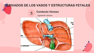 Conducto Venoso
Ligamento Venoso
5
DERIVADOS DE LOS VASOS Y ESTRUCTURAS FETALES
 