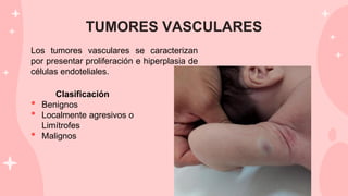 TUMORES VASCULARES
Los tumores vasculares se caracterizan
por presentar proliferación e hiperplasia de
células endoteliales.
Clasificación
• Benignos
• Localmente agresivos o
Limítrofes
• Malignos
 