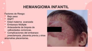 HEMANGIOMA INFANTIL
Factores de Riesgo:
• Bajo peso
• RNPT
• Edad materna avanzada
• Embarazo Múltiple
• Antacedente de biopsia de
vellosidades corionicas.
• Complicaciones del embarazo:
preeclampsia, placenta previa y otras
anomalías placentarias.
 