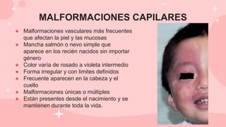 MALFORMACIONES CAPILARES
● Malformaciones vasculares más frecuentes
que afectan la piel y las mucosas
● Mancha salmón o nevo simple que
aparece en los recién nacidos sin importar
género
● Color varía de rosado a violeta intermedio
● Forma irregular y con limites definidos
● Frecuente aparecen en la cabeza y el
cuello
● Malformaciones únicas o múltiples
● Están presentes desde el nacimiento y se
mantienen durante toda la vida.
 