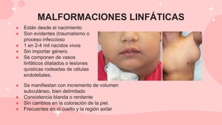 MALFORMACIONES LINFÁTICAS
● Están desde el nacimiento
● Son evidentes (traumatismo o
proceso infeccioso
● 1 en 2-4 mil nacidos vivos
● Sin importar género.
● Se componen de vasos
linfáticos dilatados o lesiones
quísticas rodeadas de células
endoteliales.
● Se manifiestan con incremento de volumen
subcutáneo, bien delimitado
● Consistencia blanda o renitente
● Sin cambios en la coloración de la piel.
● Frecuentes en el cuello y la región axilar
 