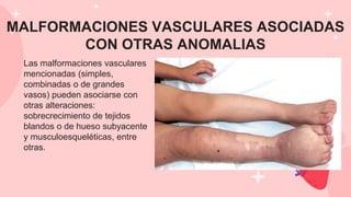 MALFORMACIONES VASCULARES ASOCIADAS
CON OTRAS ANOMALIAS
Las malformaciones vasculares
mencionadas (simples,
combinadas o de grandes
vasos) pueden asociarse con
otras alteraciones:
sobrecrecimiento de tejidos
blandos o de hueso subyacente
y musculoesqueléticas, entre
otras.
 