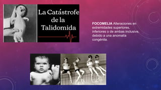 Focomelia Rx DESARROLLO EMBRIOFETAL Y CAMBIOS FISIOLOGICOS DEL EMBARAZO.pptx
