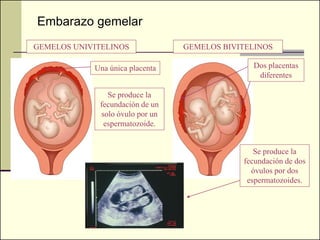 Embarazo gemelar
GEMELOS UNIVITELINOS             GEMELOS BIVITELINOS

            Una única placenta                 Dos placentas
                                                diferentes

               Se produce la
             fecundación de un
             solo óvulo por un
              espermatozoide.


                                                Se produce la
                                             fecundación de dos
                                               óvulos por dos
                                              espermatozoides.
 