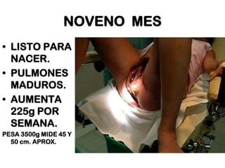 NOVENO MES
• LISTO PARA
NACER.
• PULMONES
MADUROS.
• AUMENTA
225g POR
SEMANA.
PESA 3500g MIDE 45 Y
50 cm. APROX.

 