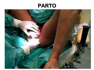 PARTO

 