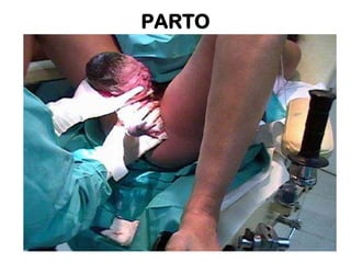 PARTO

 