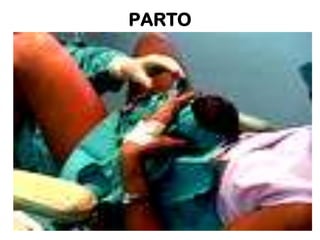 PARTO

 