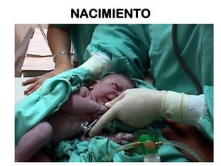 NACIMIENTO

 