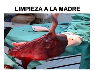 LIMPIEZA A LA MADRE

 