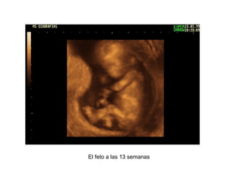 El feto a las 13 semanas 