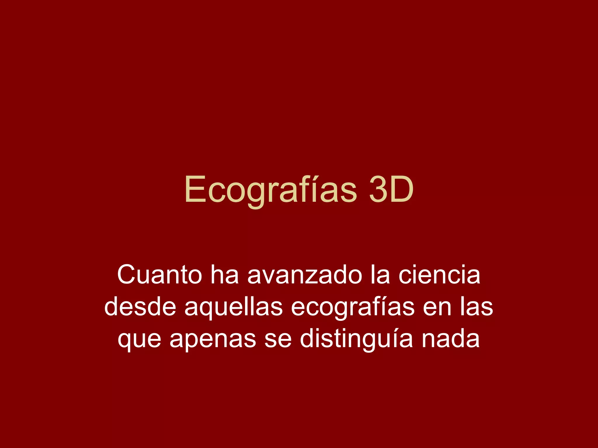 Ecografías 3D Cuanto ha avanzado la ciencia desde aquellas ecografías en las que apenas se distinguía nada