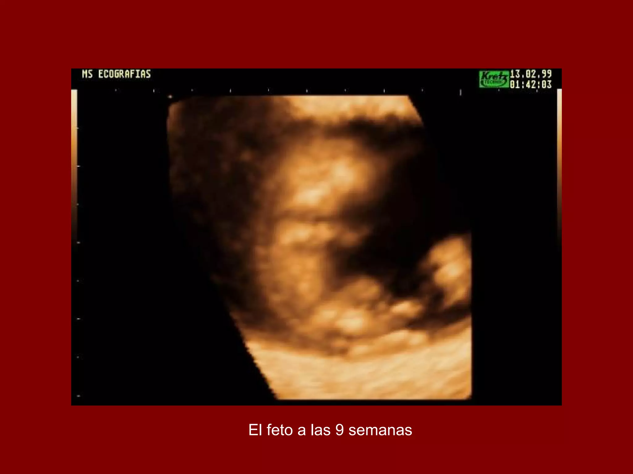 El feto a las 9 semanas